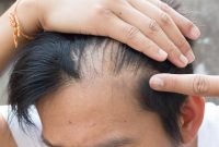 √ 7 Cara Menumbuhkan Rambut Secara Alami (Cepat dan Ampuh)