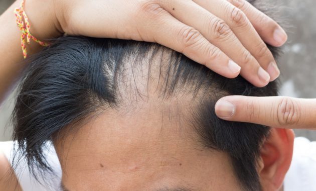 √ 7 Cara Menumbuhkan Rambut Secara Alami (Cepat dan Ampuh)