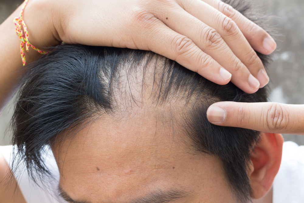 Featured image of post Bagaimana Cara Menumbuhkan Rambut Dengan Cepat Memiliki rambut panjang dan lebat adalah impian hampir sebagian wanita dengan rambut yang panjang serta lebat tentu akan menambah kepercayaan diri anda