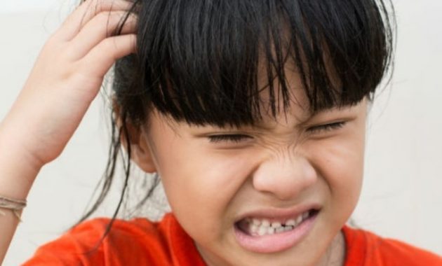 √ 11 Cara Menghilangkan Kutu Rambut | Cara Penularan dan Pencegahannya